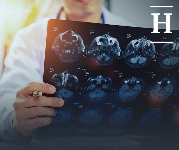 Brain Injury